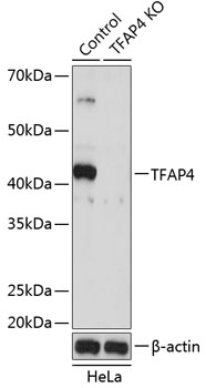 Anti-TFAP4 Antibody [KO Validated] (CAB16727)