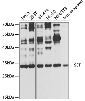 Anti-SET Antibody (CAB12502)