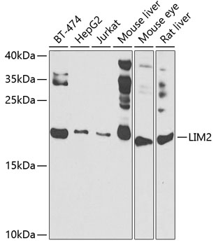 Anti-LIM2 Antibody (CAB7909)