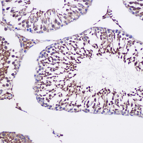 Anti-TUBGCP6 Antibody (CAB15921)