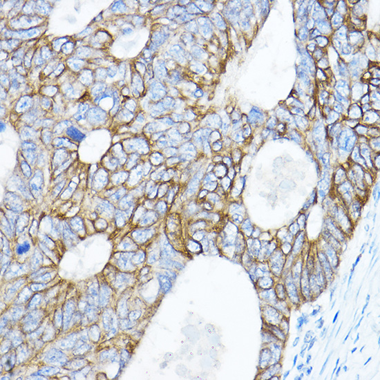 Anti-TMPRSS2 Antibody (CAB1979)