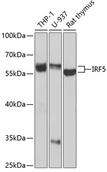 Anti-IRF5 Antibody (CAB1149)