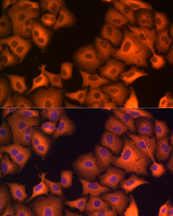 Immunofluorescence analysis of A-549 cells using HSP70 Rabbit pAb at dilution of 1:100 (40x lens). Blue: DAPI for nuclear staining.