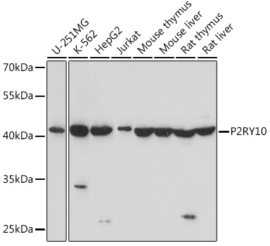 Anti-P2RY10 Antibody (CAB16517)