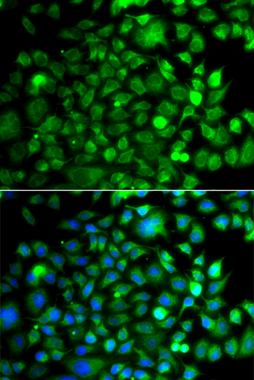 Anti-OSGEP Antibody (CAB7473)