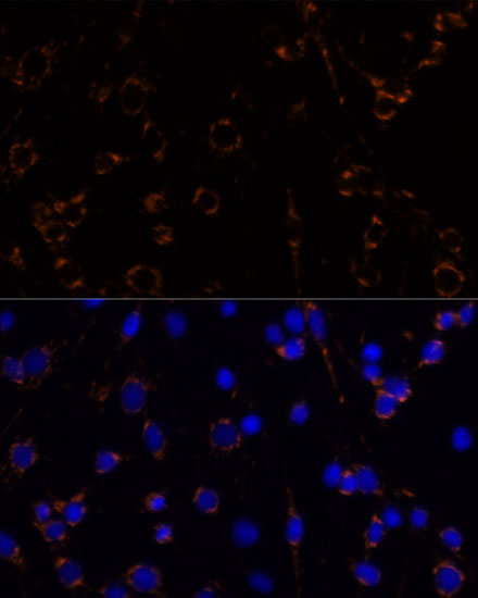 Anti-MDH2 Antibody (CAB6297)