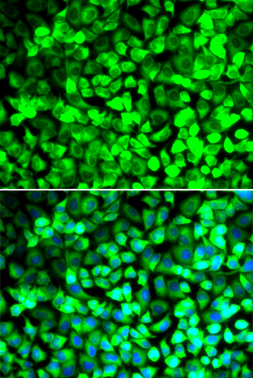 Anti-EIF5 Antibody (CAB6583)