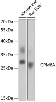 Anti-GPM6A Antibody (CAB12439)