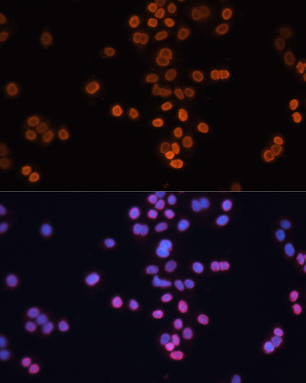 Anti-CDX2 Antibody (CAB1629)