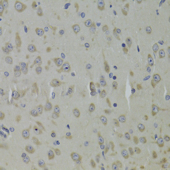 Anti-RPL9 Antibody (CAB13632)