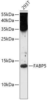 Anti-FABP5 Antibody (CAB0947)