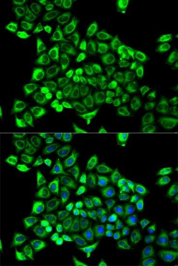 Anti-CDA Antibody (CAB2006)