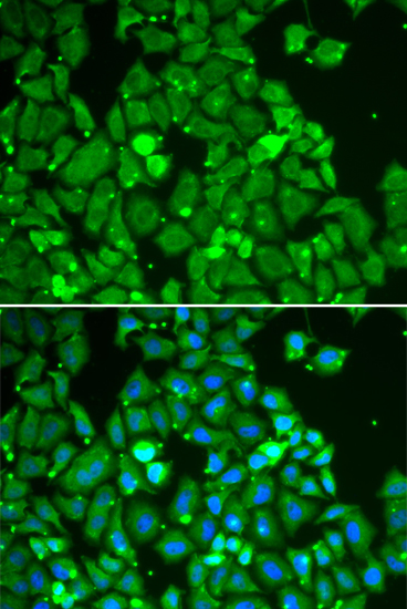 Anti-STAT1 Antibody (CAB12330)