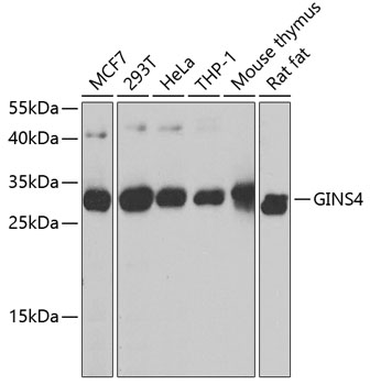 Anti-GINS4 Polyclonal Antibody (CAB8592)