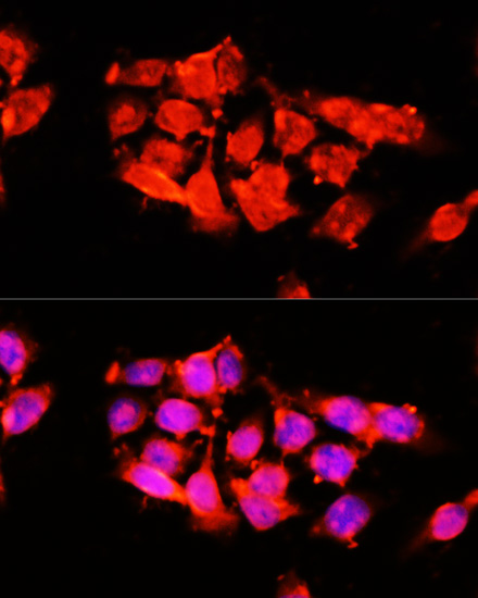 Anti-A1BG Antibody (CAB15015)