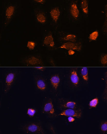 Anti-RPL34 Antibody (CAB15716)