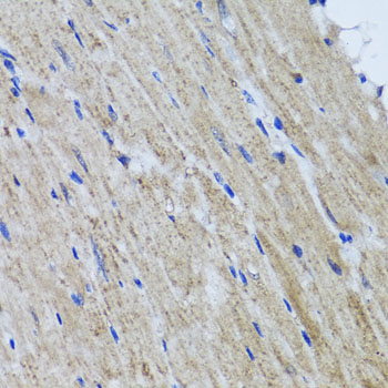 Anti-HYAL1 Antibody (CAB6623)