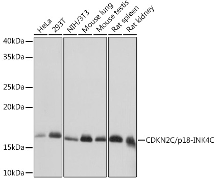 Anti-CDKN2C/p18-INK4C Antibody (CAB8751)