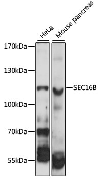 Anti-SEC16B Antibody (CAB14678)