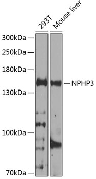 Anti-Nephrocystin-3 Polyclonal Antibody (CAB8580)