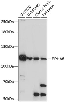 Anti-EPHA5 Antibody (CAB14238)