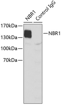 Anti-NBR1 Antibody (CAB3949)