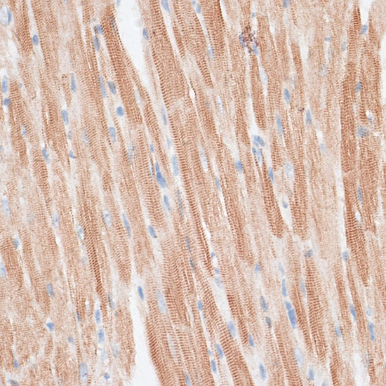 Anti-GRK5 Antibody (CAB3899)