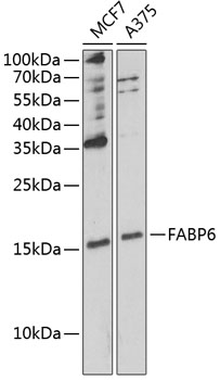 Anti-FABP6 Antibody (CAB6906)