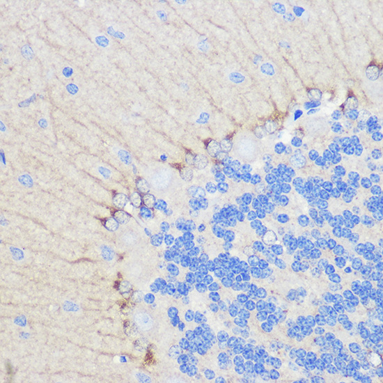 Anti-DLG4 Antibody (CAB6194)