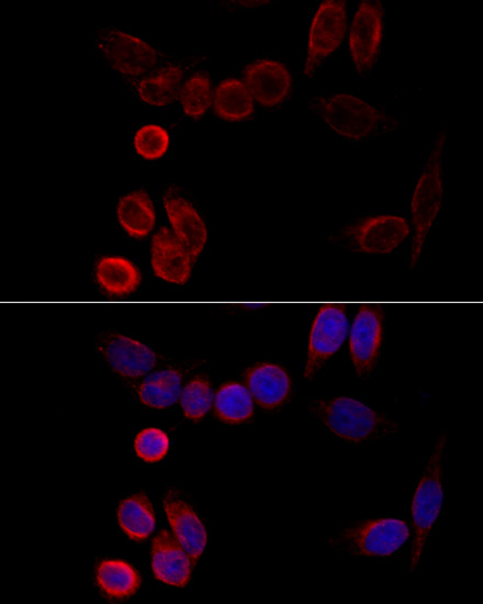 Anti-CYP2A6 Antibody (CAB15044)