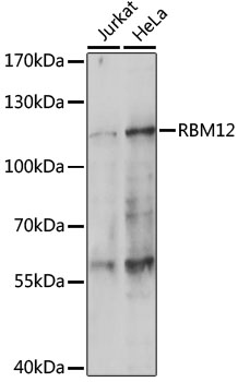 Anti-RBM12 Antibody (CAB14683)