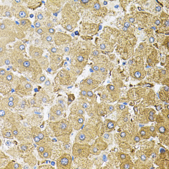 Anti-CEP164 Polyclonal Antibody (CAB9964)