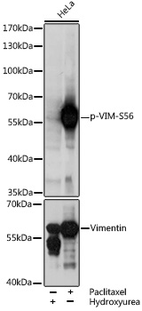 Anti-Phospho-VIM-S56 pAb (CABP0804)