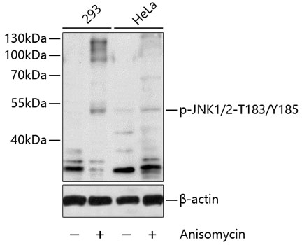 Anti-Phospho-JNK1/2-T183/Y185 Antibody (CABP0473)