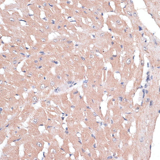 Anti-COL11A1 Antibody (CAB10559)