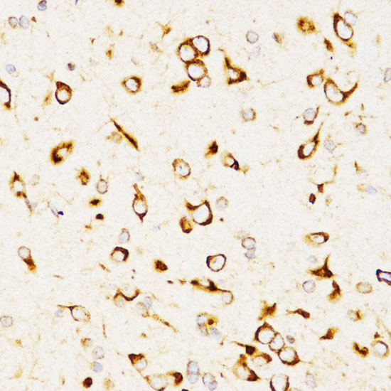 Anti-LAMP3 Antibody (CAB2895)