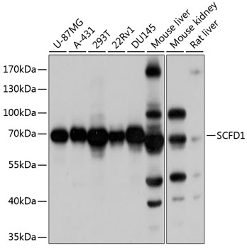 Anti-SCFD1 Polyclonal Antibody (CAB8835)