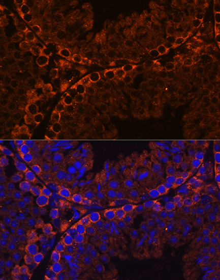 Anti-CFAP69 Antibody (CAB18193)