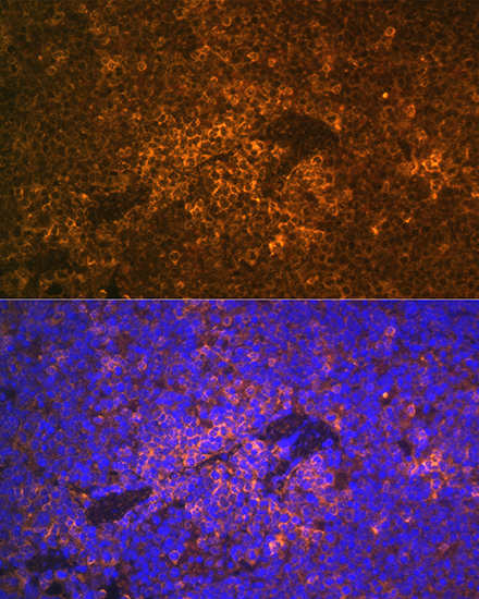 Anti-S100A12 Antibody (CAB5328)