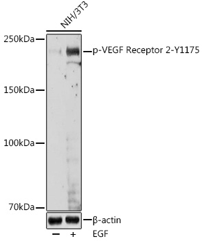 Anti-Phospho-KDR-Y1175 Antibody (CABP0382)