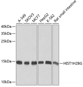 Anti-HIST1H2BG Antibody (CAB9896)