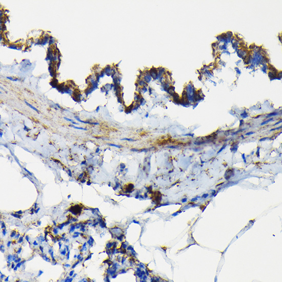 Anti-TNFR1 Antibody (CAB1540)