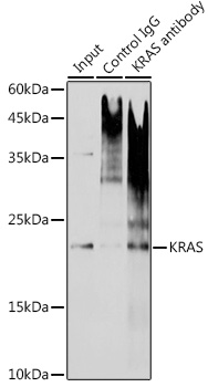 Anti-KRAS Antibody [KO Validated] (CAB12704)