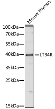 Anti-LTB4R Antibody (CAB15042)