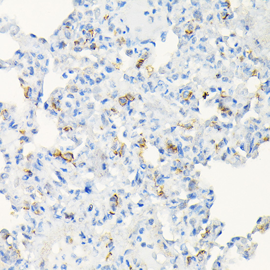 Anti-ACE2 Antibody (CAB12737)