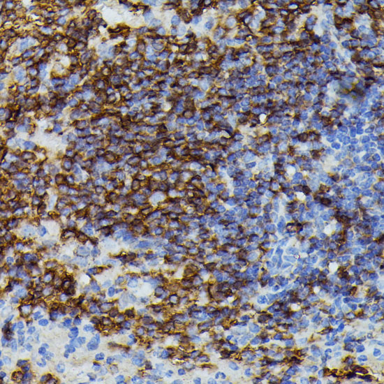 Anti-APOC3 Antibody (CAB1409)