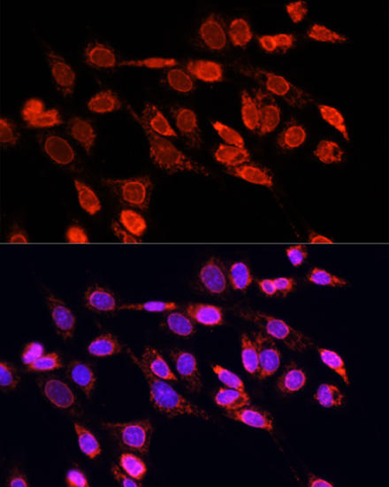 Anti-EIF4EBP1 Antibody [KO Validated] (CAB1248)