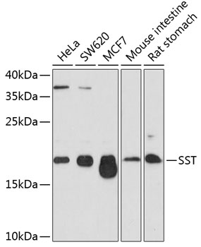 Anti-Somatostatin Polyclonal Antibody (CAB9274)