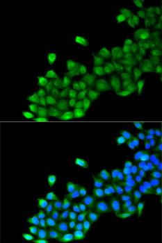 Anti-GC Antibody (CAB5709)