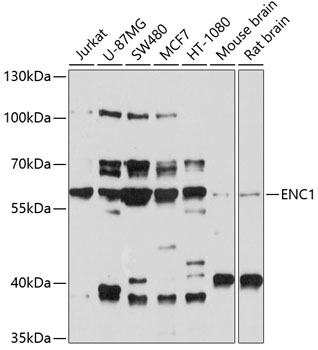 Anti-ENC1 Antibody (CAB10257)